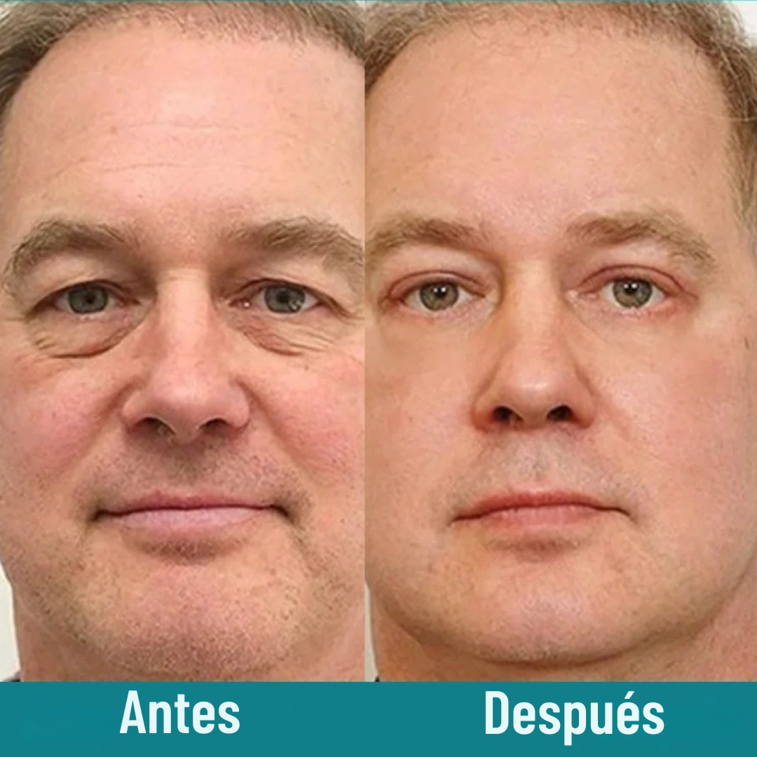 Eelhoe® - Crema Antiedad de Colageno