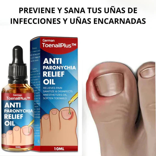 (2x1) Tratamiento para eliminar Hongos de uña 100% Natural🍃- LLEVE 2 Y PAGUE 1