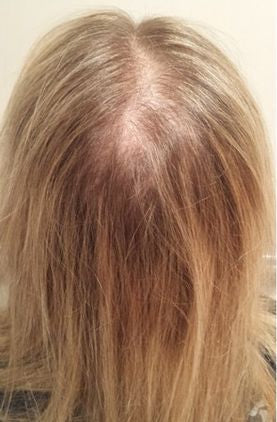 Multi-Peptide Serum para Cabello - 3 Meses