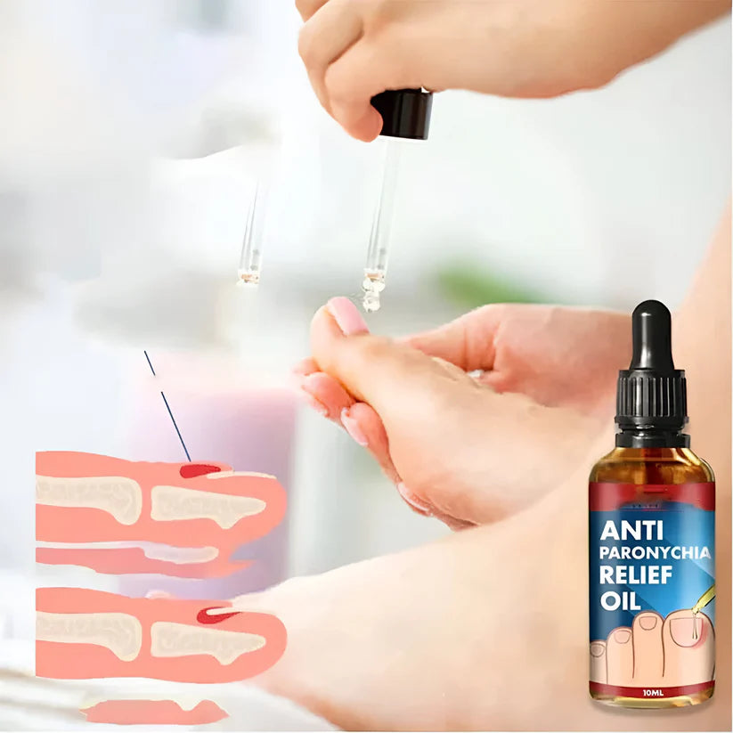 (2x1) Tratamiento para eliminar Hongos de uña 100% Natural🍃- LLEVE 2 Y PAGUE 1