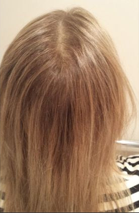 Multi-Peptide Serum para Cabello - 3 Meses