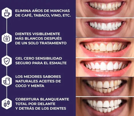 SumaStrips® - Kit de blanqueamiento dental profesional COMPRE 1 Y LLÉVESE + 1 DE REGALO